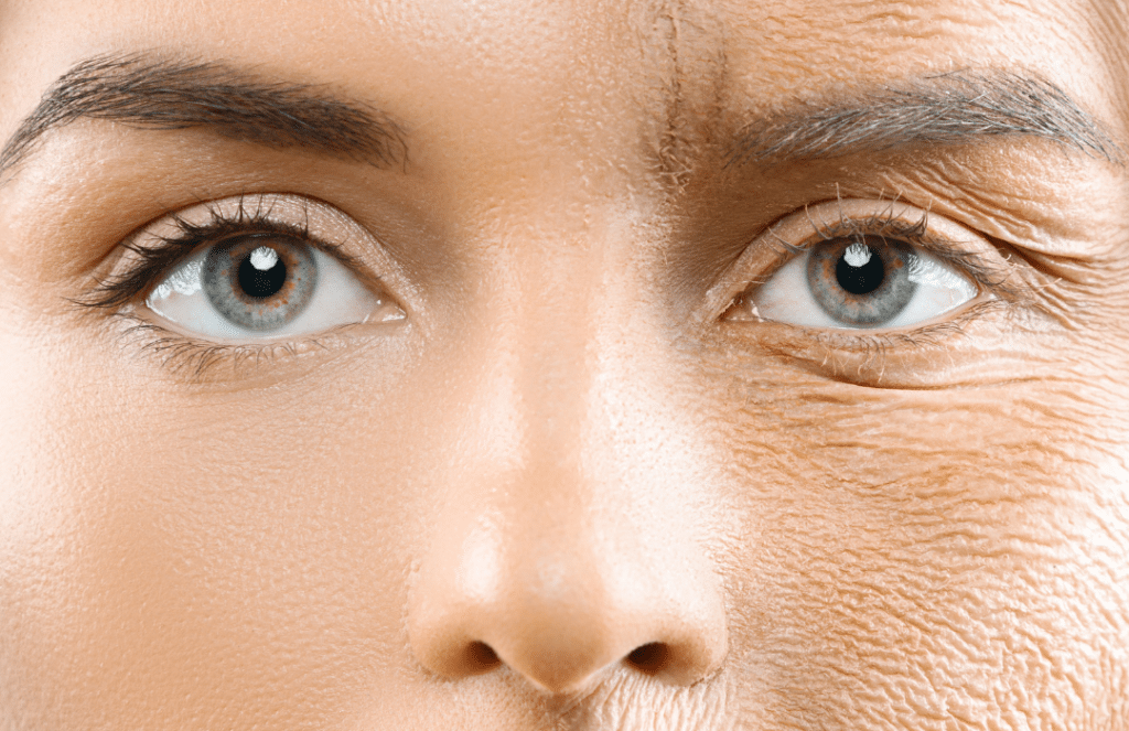 The Role of Collagen in Anti-Aging and Wrinkle Reduction