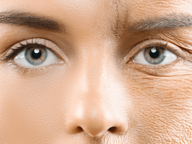 The Role of Collagen in Anti-Aging and Wrinkle Reduction