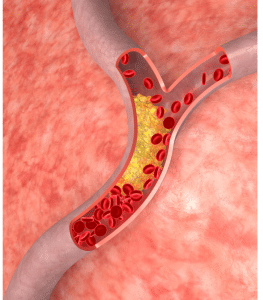 improved blood flow