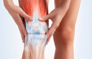 arthritis of the knee